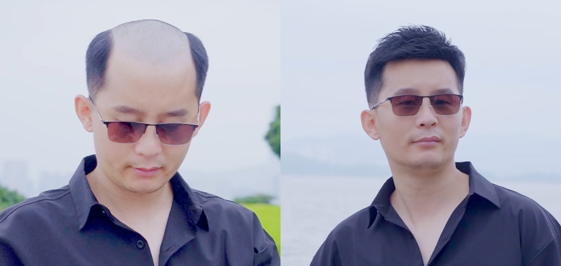 男士假發(fā)案例視頻