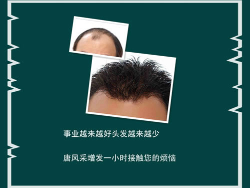 ���L(f��ng)�ɼٰl(f��)