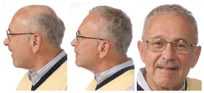 ���_�����^�����ܷ�Ó�l(f��)�Ͱװl(f��)