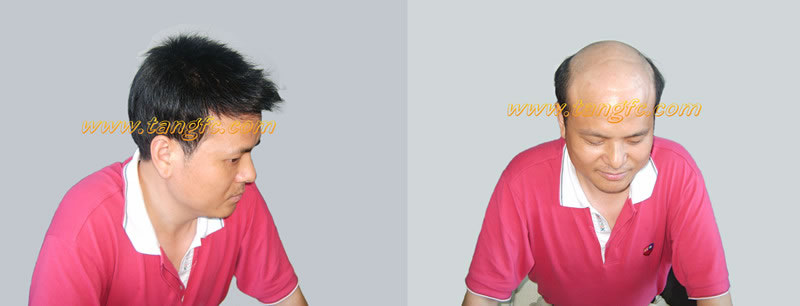 吃什么讓白發(fā)變黑 吃什么讓白發(fā)變黑