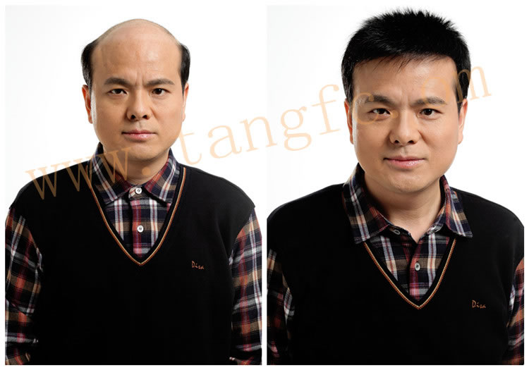 油性頭發(fā)怎么護理 油性頭發(fā)怎么護理