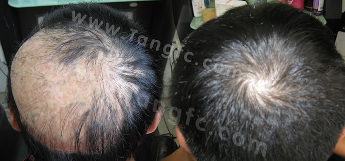 太原織發(fā)補發(fā)哪家做的專業(yè)？