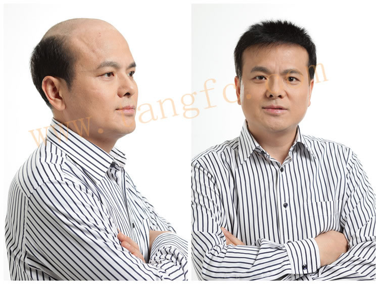 李開復患淋巴癌，現(xiàn)代人透支健康、過早脫發(fā)引人深思