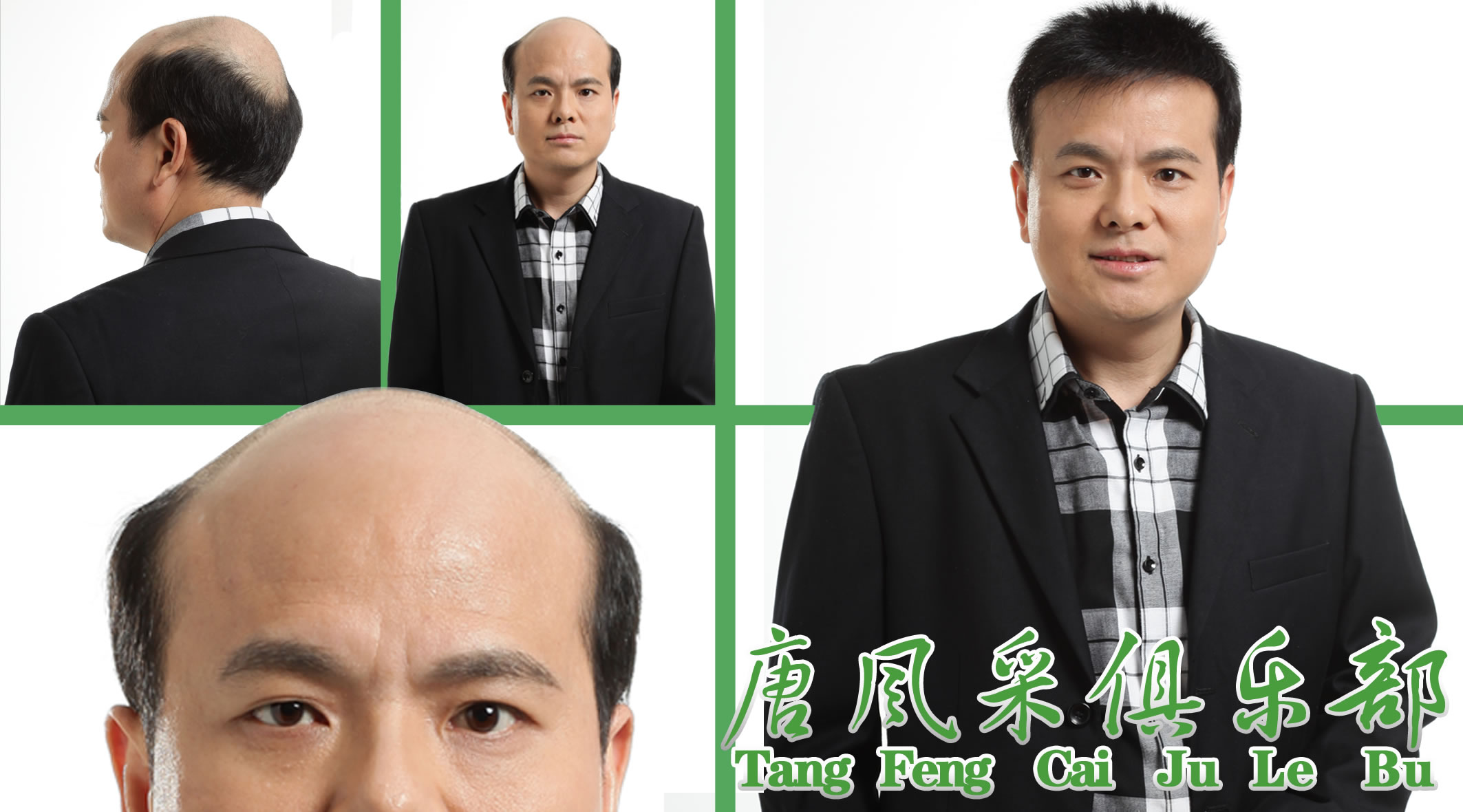 深圳織發(fā)效果圖 深圳織發(fā)做的怎么樣