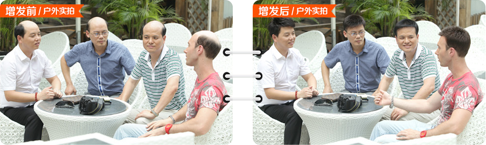 黑發(fā)變白怎么辦？