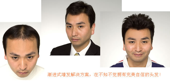 唐風采織發(fā)補發(fā)