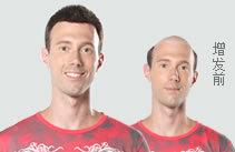 銀川店男士織發(fā)補發(fā)案例