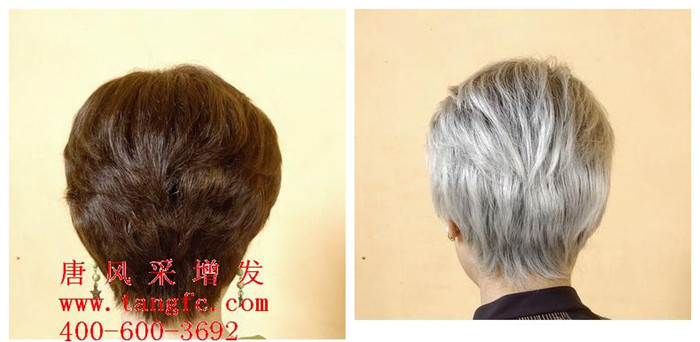 怎樣才能讓白發(fā)變黑？分享白發(fā)變黑方案！