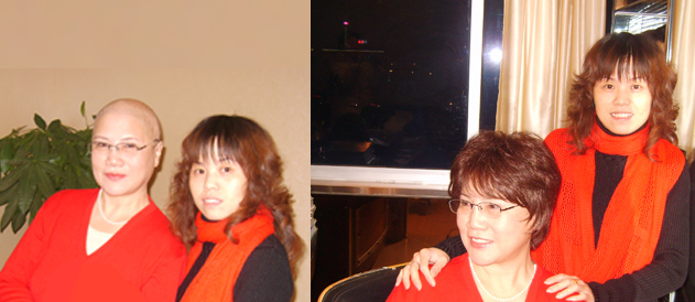 女士脂溢性脫發(fā)也可以用無痕織發(fā)補發(fā)嗎？