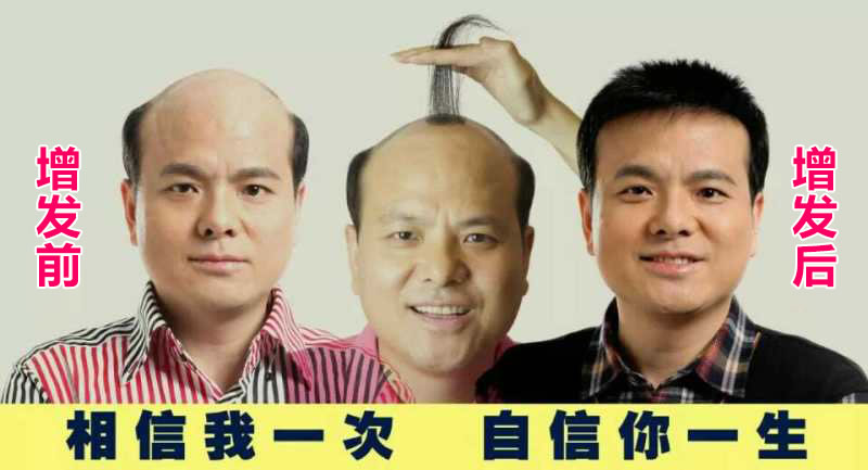 補頭發(fā)的食物有哪些 電子時代如何防脫發(fā)