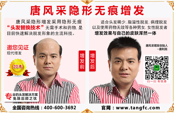 禿頂植發(fā)要多少錢？脫發(fā)禿頂又與頭皮屑有什么關(guān)聯(lián)？