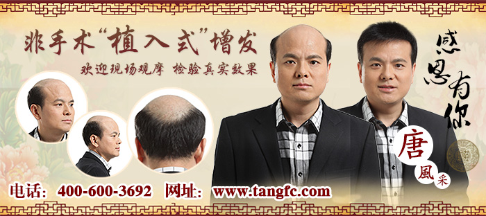 2015織發(fā)哪個(gè)牌子好？