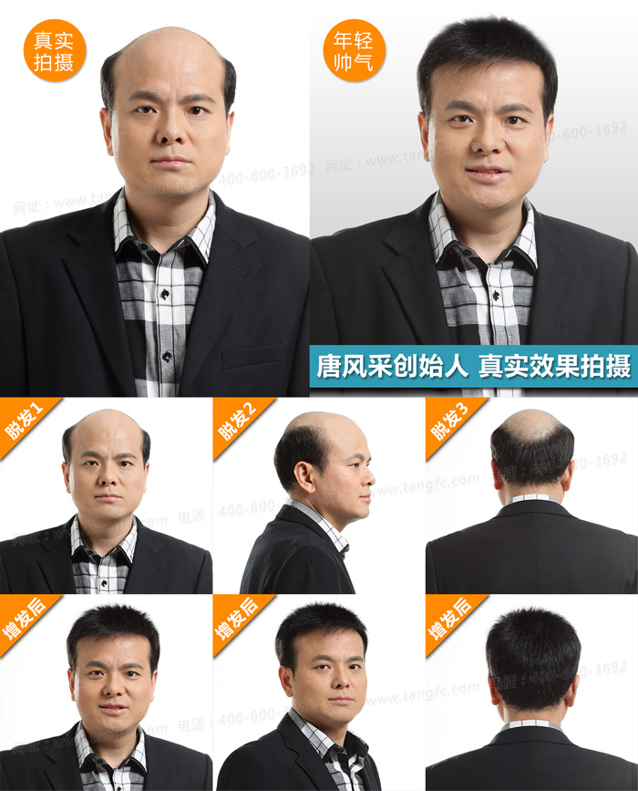禿頂了，品牌假發(fā)定做為你保駕護(hù)航