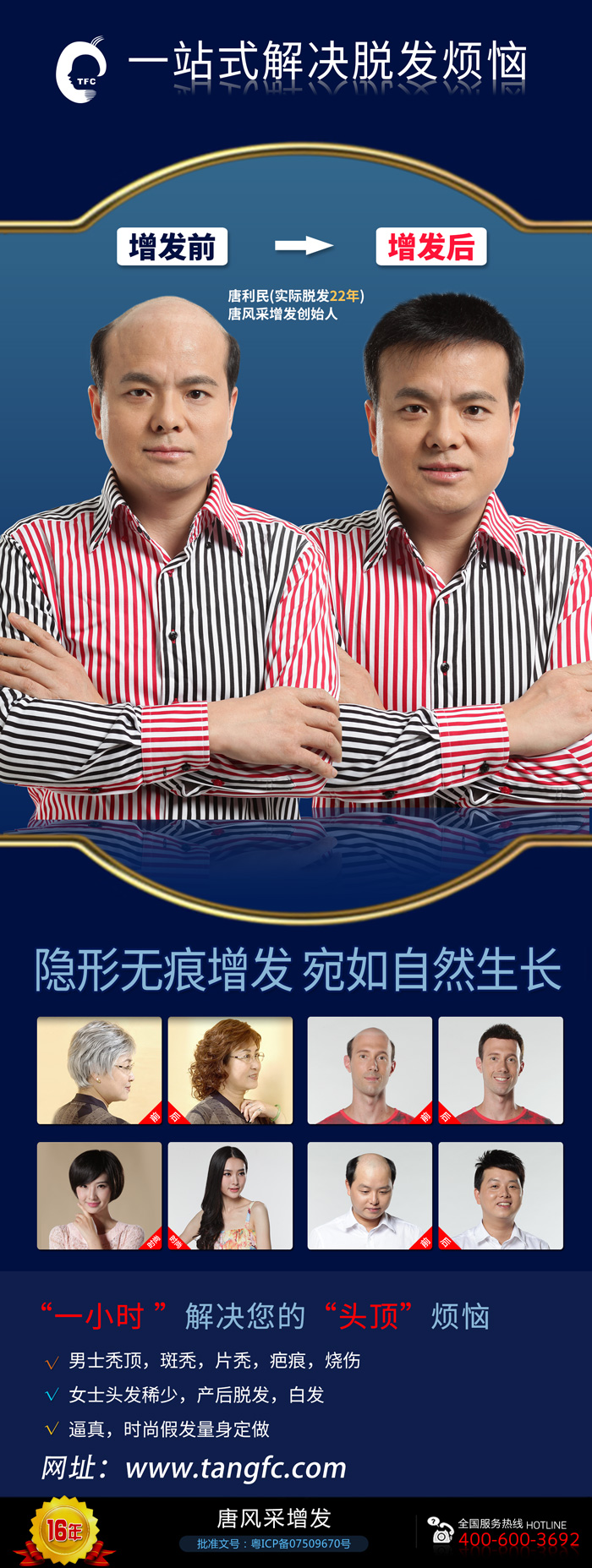 無(wú)痕補(bǔ)發(fā)價(jià)格是多少？哪里補(bǔ)發(fā)技術(shù)比較好？