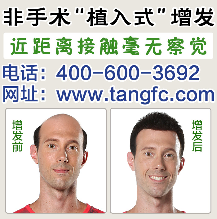 脫發(fā)怎么辦？品牌假發(fā)定做技術(shù)成熟嗎？