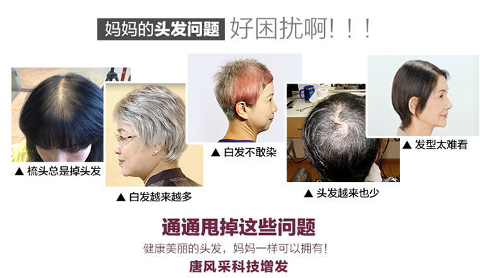 日常習(xí)慣要注意，防火防盜防白發(fā)脫發(fā)！