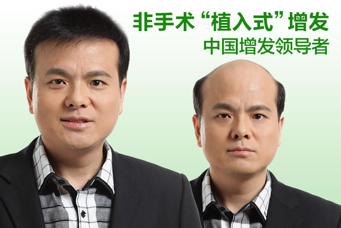 頭發(fā)稀少用什么？預(yù)防與解決需要懂這些