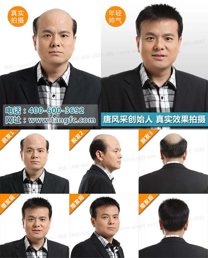 呼和浩特哪里有織發(fā)？織發(fā)后如何護(hù)理？