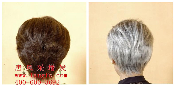 哈爾濱白發(fā)解決機構(gòu)哪家好？