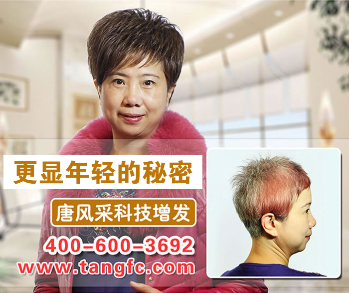 南寧最好的織發(fā)店在哪？脫發(fā)用織發(fā)可以救嗎？