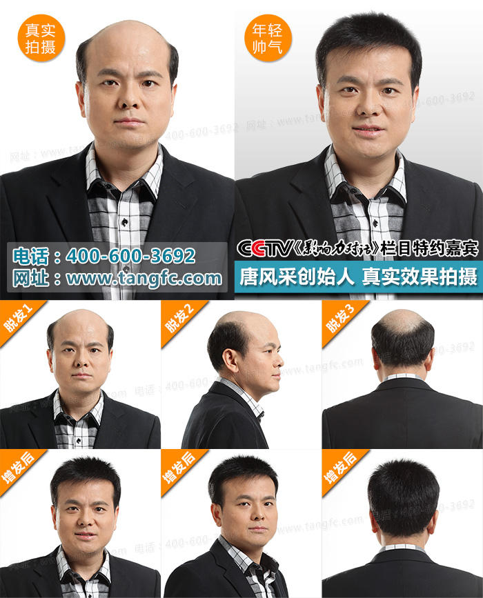 唐風(fēng)采假發(fā)用戶專訪：告別禿頂，自信生活從此開(kāi)始