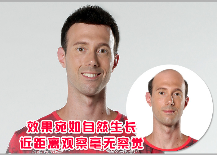 有白頭發(fā)怎么辦？一小時(shí)免費(fèi)解決等你來