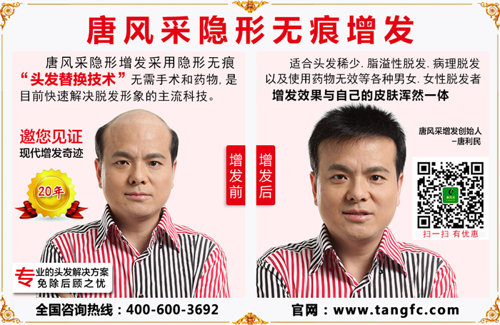 南京白發(fā) 南京白發(fā)機(jī)構(gòu)選擇這家的多一些