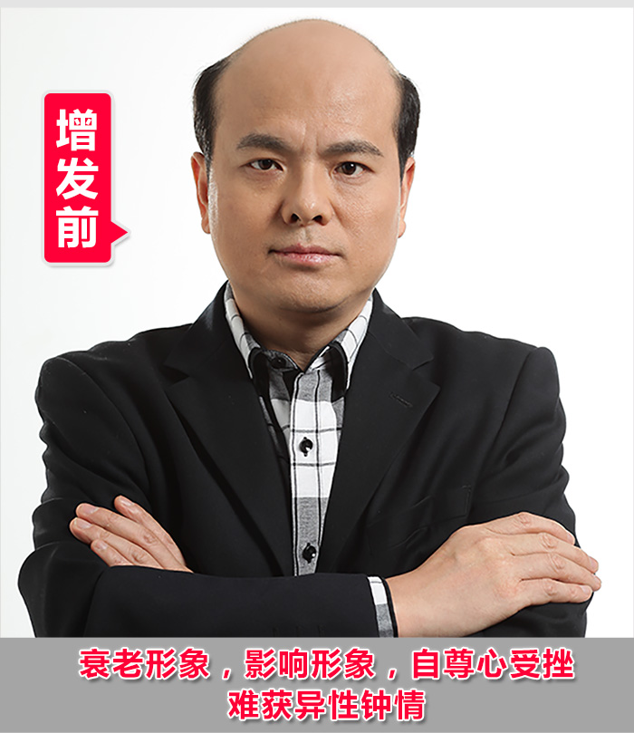 紹興專業(yè)織發(fā)補(bǔ)發(fā) 織發(fā)補(bǔ)發(fā)達(dá)人分享:紹興專業(yè)織發(fā)補(bǔ)發(fā)帶給您不一樣的體驗(yàn)