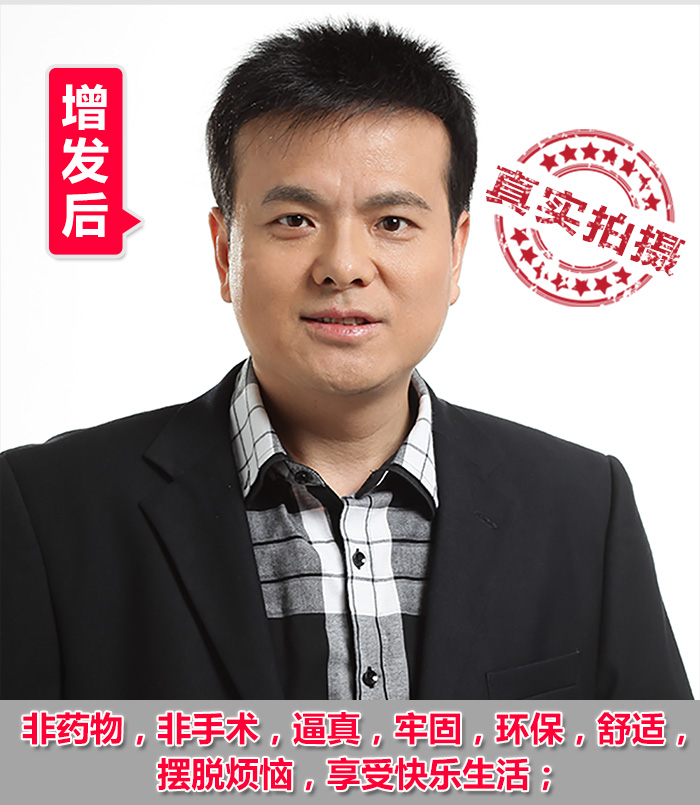 紹興專業(yè)織發(fā)補(bǔ)發(fā) 織發(fā)補(bǔ)發(fā)達(dá)人分享:紹興專業(yè)織發(fā)補(bǔ)發(fā)帶給您不一樣的體驗(yàn)