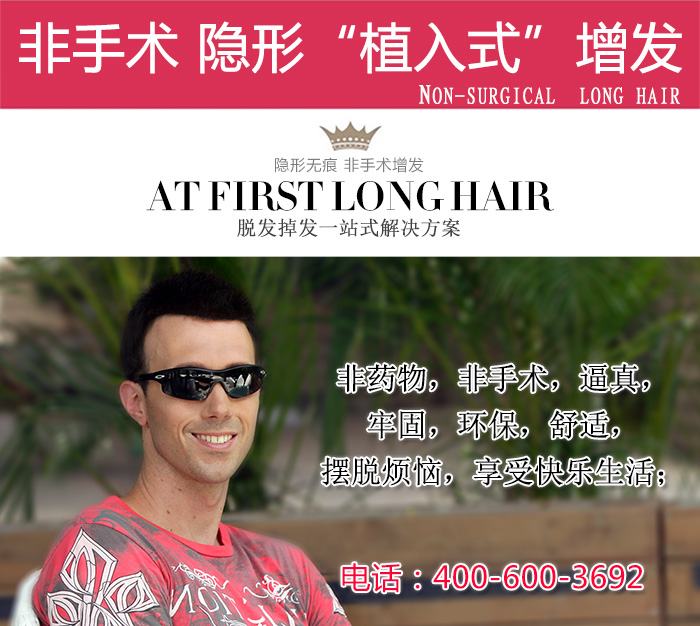 紹興織發(fā)補(bǔ)發(fā)中心 稀發(fā)者福音:紹興織發(fā)補(bǔ)發(fā)中心用無敵的技術(shù)傲視群雄