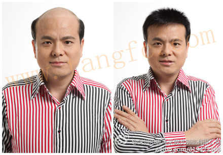 佛山織發(fā)哪里效果最好？它有什么特點(diǎn)？