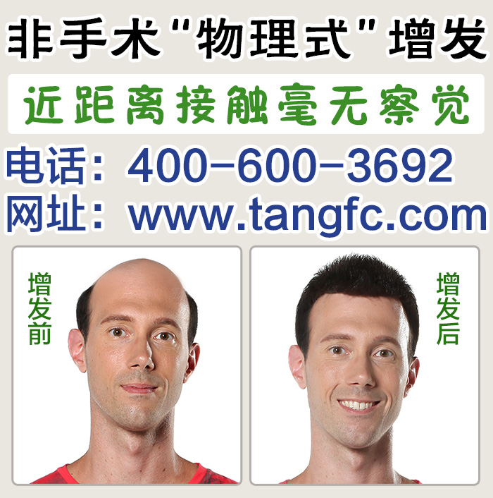 漳州高檔假發(fā)什么品牌好？哪里可以定做