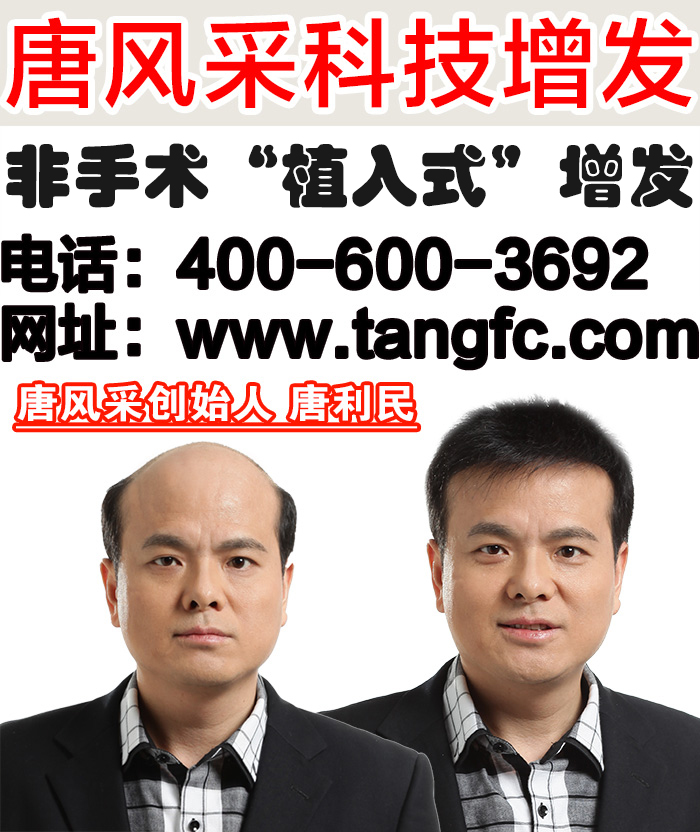 真人發(fā)中年男士假發(fā)多少錢？中年人為何易禿