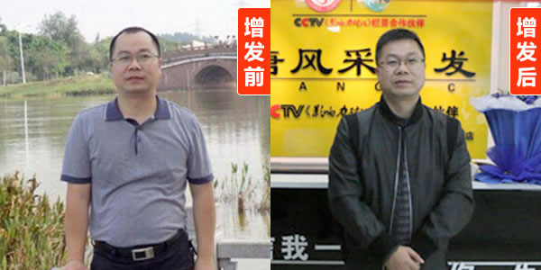 在佛山有哪些織發(fā)補(bǔ)發(fā)店？唐風(fēng)采這家怎么樣？