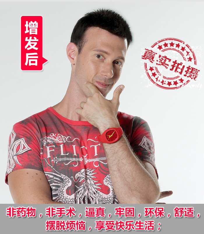 柳州織發(fā)哪里好？禿頂多年都忘記有頭發(fā)的樣子了！