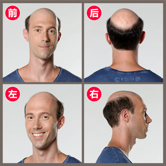 金華織發(fā)哪里效果最好？論效果當(dāng)屬唐風(fēng)采假發(fā)！