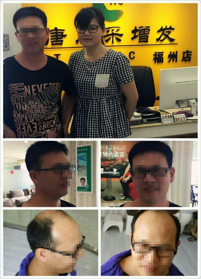 脫發(fā)后“藍(lán)瘦、香菇”，那你還在等什么？