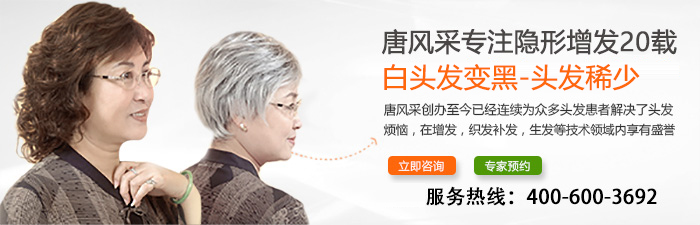 柳州買隱形假發(fā)哪家好？唐風(fēng)采的高超技術(shù)征服了我