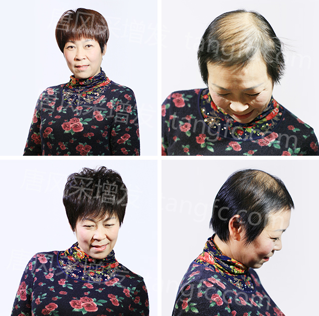 蘭州織發(fā)哪里效果最好？唐風(fēng)采蘭州店給您滿意答案！