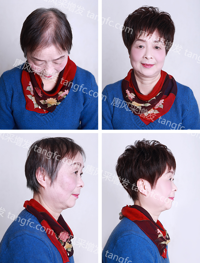 織發(fā)補發(fā)可以使人有好心情，好心情則可以改變命運