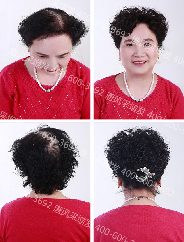 無(wú)錫織發(fā)哪里效果最好？成功與失敗只在一念之間！