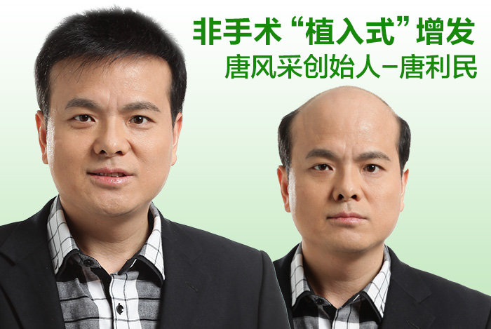 脫發(fā)高危人群 脫發(fā)高危人群——IT男更要謹(jǐn)慎護(hù)發(fā)