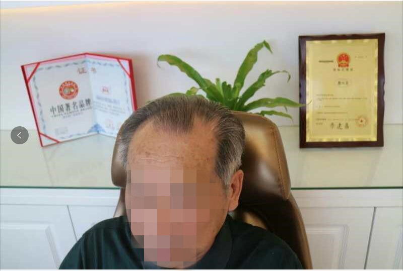 “大爺”秒變“萌叔”？唐風采假發(fā)為您保守年齡的秘密！