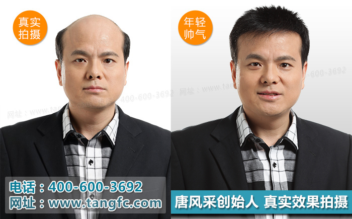 奧尼爾戴白發(fā)開懟，小伙伴們千萬別模仿！