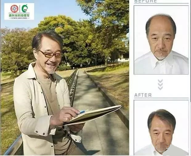 來自NASA的黑科技生發(fā)頭盔，禿頂有救了？