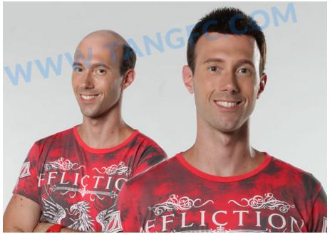 脫發(fā)有望完全治愈？美科學(xué)研究發(fā)現(xiàn)脫發(fā)秘密！