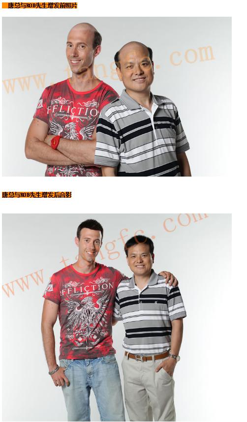 貝克漢姆的中年危機(jī)，脫發(fā)繞過誰？