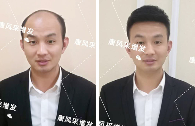 輸了頭發(fā)不能輸氣質(zhì)，看帥哥的逆襲之路！