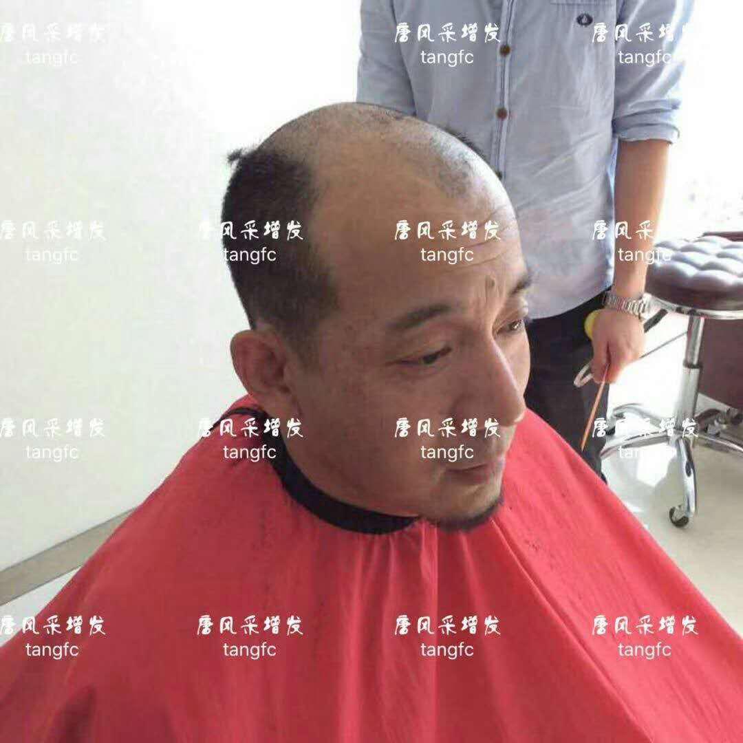  生發(fā)了這么久，但凡有效果的也該有些跡象了