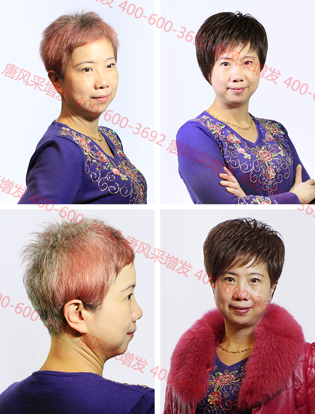 紹興織發(fā)哪里好？唐風(fēng)采亮法寶解決頭發(fā)稀少！